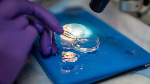 Pipette being used to place something into a petri dish, with microscope overhead.